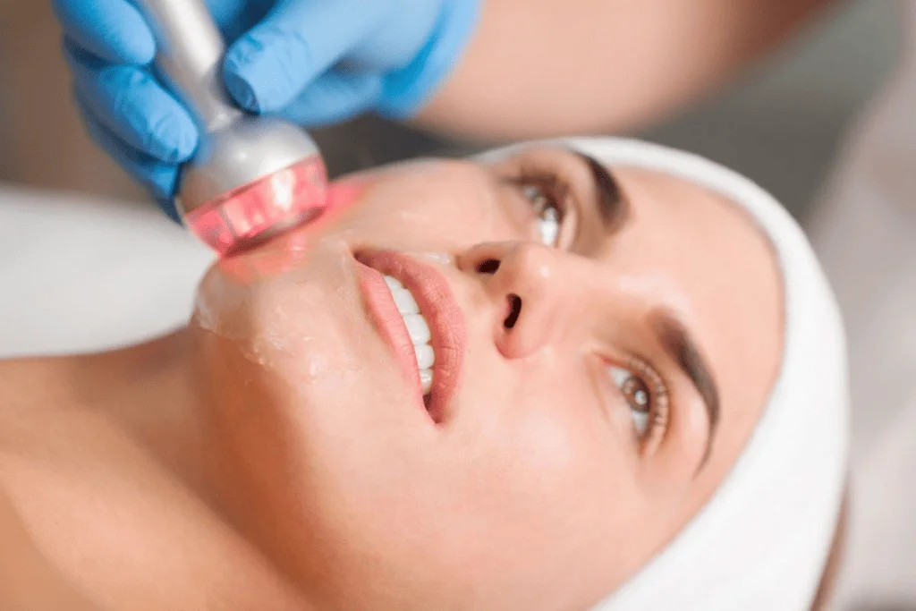 Lifting Facial con Radiofrecuencia image